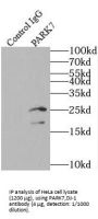PARK7,DJ-1 Antibody