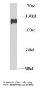 Poly ADP-Ribose Polymerase 1 (PARP1) Antibody