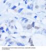 Poly ADP-Ribose Polymerase 1 (PARP1) Antibody