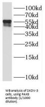 Paired Box 8 (PAX8) Antibody
