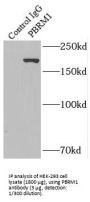 Protein Polybromo-1 (PBRM1) Antibody