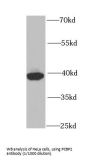Poly(RC) Binding Protein 2 (PCBP2) Antibody