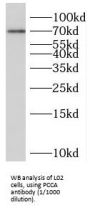 Propionyl-CoA Carboxylase Alpha Subunit (PCCA) Antibody
