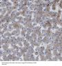 Propionyl-CoA Carboxylase Alpha Subunit (PCCA) Antibody