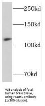 Protocadherin 1 (PCDH1) Antibody