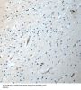 Peroxisomal Biogenesis Factor 5 Like (PEX5L) Antibody