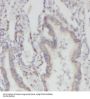 Prefoldin Subunit 2 (PFDN2) Antibody