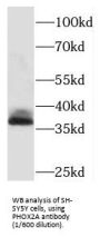 Paired Like Homeobox 2a (PHOX2A) Antibody