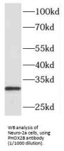 Paired Like Homeobox 2b (PHOX2B) Antibody