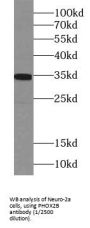 Paired Like Homeobox 2b (PHOX2B) Antibody