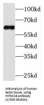 Phosphatidylinositol-4-Phosphate 5-Kinase Type 1 Beta (PIP5K1B) Antibody