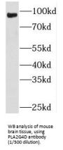 Phospholipase A2, Group IV D (PLA2G4D) Antibody