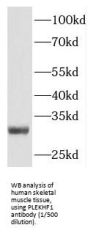 Pleckstrin Homology And FYVE Domain Containing 1 (PLEKHF1) Antibody