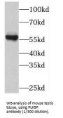 Polo Like Kinase 5 (PLK5) Antibody