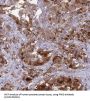 Probable Hydrolase PNKD (PNKD) Antibody