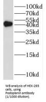 Podoplanin (PDPN) Antibody