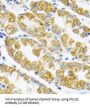 Polymerase DNA Directed Gamma 2 (POLG2) Antibody
