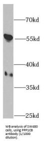 Serine/threonine-Protein Phosphatase PP1-Beta Catalytic Subunit (PPP1CB) Antibody