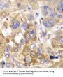Serine/threonine-Protein Phosphatase PP1-Beta Catalytic Subunit (PPP1CB) Antibody