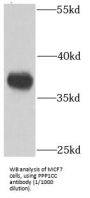 Protein Phosphatase 1 Catalytic Subunit Gamma (PPP1CC) Antibody
