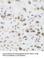 Protein Phosphatase 1 Catalytic Subunit Gamma (PPP1CC) Antibody