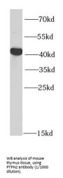 Protein Tyrosine Phosphatase, Non Receptor Type 2 (PTPN2) Antibody