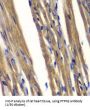 Protein Tyrosine Phosphatase, Non Receptor Type 2 (PTPN2) Antibody