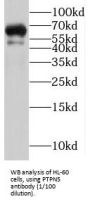 Protein Tyrosine Phosphatase, Non Receptor Type 5 (PTPN5) Antibody