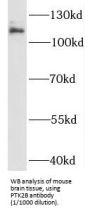 Protein-Tyrosine Kinase 2-Beta (PYK2) Antibody