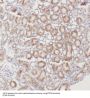Protein-Tyrosine Kinase 2-Beta (PYK2) Antibody