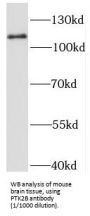 Protein-Tyrosine Kinase 2-Beta (PYK2) Antibody