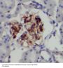 Protein-Tyrosine Kinase 2-Beta (PYK2) Antibody
