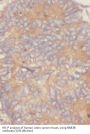 RAB3B, Member RAS Oncogene Family (RAB3B) Antibody