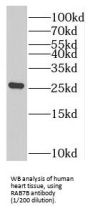 RAB7B, Member RAS Oncogene Family (RAB7B) Antibody