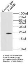 RAB8B, Member RAS Oncogene Family (RAB8B) Antibody