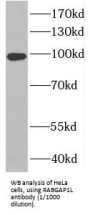 Rab GTPase-Activating Protein 1-Like, Isoform 10 (RABGAP1L) Antibody