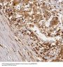 Rab GTPase-Activating Protein 1-Like, Isoform 10 (RABGAP1L) Antibody
