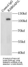 Rab GTPase-Activating Protein 1-Like, Isoform 10 (RABGAP1L) Antibody