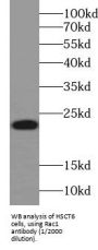 Ras Related C3 Botulinum Toxin Substrate 1 (RAC1) Antibody