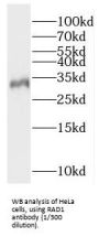 RAD1 Checkpoint DNA Exonuclease (RAD1) Antibody