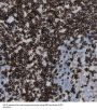 RAD1 Checkpoint DNA Exonuclease (RAD1) Antibody