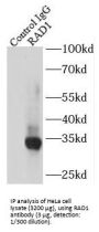 RAD1 Checkpoint DNA Exonuclease (RAD1) Antibody