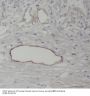 Receptor Activity Modifying Protein 3 (RAMP3) Antibody