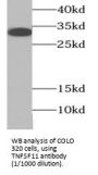Tumor Necrosis Factor Ligand Superfamily Member 11 (TNFSF11) Antibody