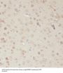 RasGEF Domain Family Member 1A (RASGEF1A) Antibody