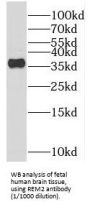 RRAD And GEM Like GTPase 2 (REM2) Antibody