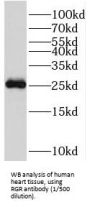 RPE-Retinal G Protein-Coupled Receptor (RGR) Antibody