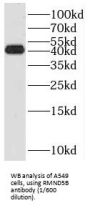 Required For Meiotic Nuclear Division 5 Homolog B (RMND5B) Antibody