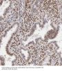 Ubiquitin-40S Ribosomal Protein S27a (RPS27A) Antibody