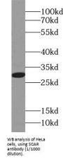 Ribosomal Protein S4, X-Linked (RPS4X) Antibody